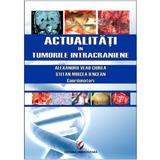 Actualitati in tumorile intracraniene - Alexandru Vlad Ciurea, Stefan Mircea Iencean, editura Universitara