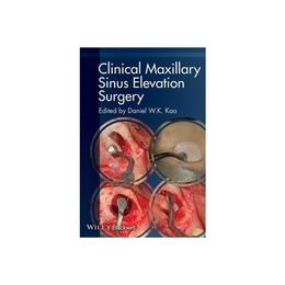 Clinical Maxillary Sinus Elevation Surgery, editura Wiley-blackwell