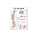 Human Spine Disorders Anatomical Chart