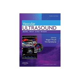 Vascular Ultrasound