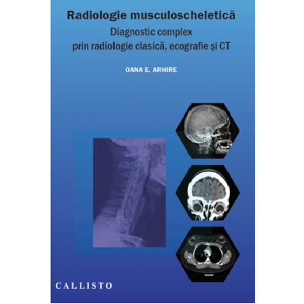 Radiologie musculoscheletica - Oana E. Arhire, editura Callisto