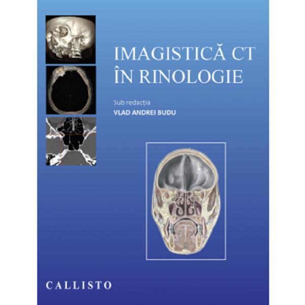 Imagistica CT in rinologie - Vlad Andrei Budu, editura Callisto