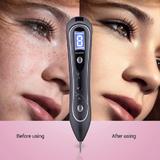 aparat-cosmetic-plasma-indepartarea-petelor-alunitelor-pistruilor-ecran-lcd-antiacnee-1-mole-removal-floral-black-5.jpg