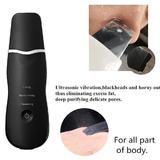 aparat-cosmetic-skin-scrubber-peeling-exfoliator-facial-multi-functional-face-lifting-beauty-machine-black-white-totulperfect-4.jpg