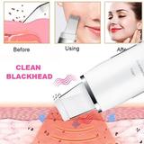 aparat-cosmetic-profesional-ultrasonic-efb-cu-ionizare-3.jpg