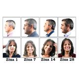 set-2-x-tratament-repigmentare-pentru-par-alb-sau-grizonat-classic-positiv-hair-phytema-150ml-150ml-4.jpg