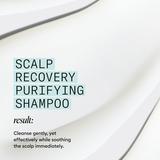 sampon-purificator-antimatreata-pentru-scalp-iritat-cu-mancarimi-nioxin-scalp-recovery-shampoo-1000-ml-1724145034412-1.jpg